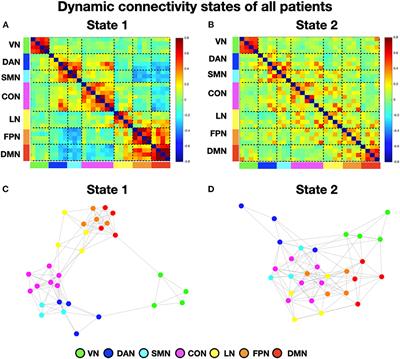 Dynamic brain states in spatial neglect after stroke